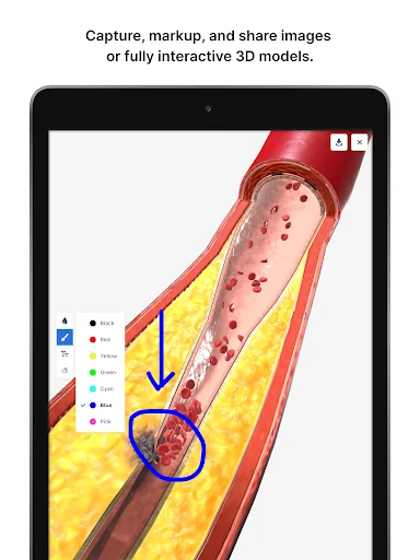 Download BioDigital Human 3D Anatomy Terbaru – Belajar Anatomi - Screenshot 11