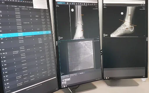 Download MedDream Multi-Monitor Extension – Viewer DICOM Gratis - Screenshot 1